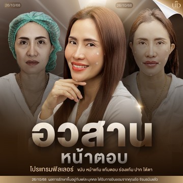 S19652616