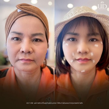 คุณกรรณิกา