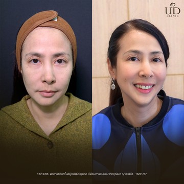 คุณนิก