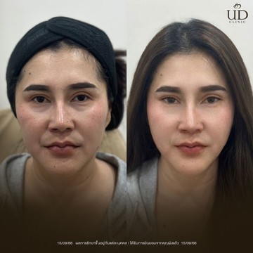 คุณผิง