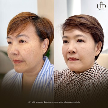 คุณฝน