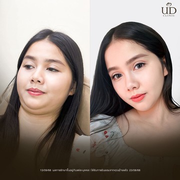คุณฝ้าย