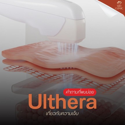 20.1 UD _ ยิง Ulthera เจ็บเหมือนโดนเข็มร้อยเล่มแทงจริงไหม_ รวมวิธีเตรียมใจและเทคนิคแปะยาชาให้เจ็บน้อยลง