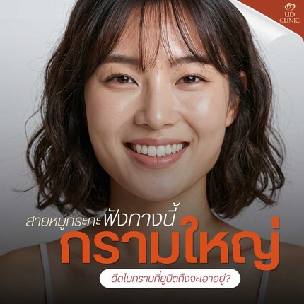 26.1 UD _ สายหมูกระทะฟังทางนี้ กรามใหญ่จากพฤติกรรม ฉีดโบกรามกี่ยูนิตถึงจะเอาอยู่_