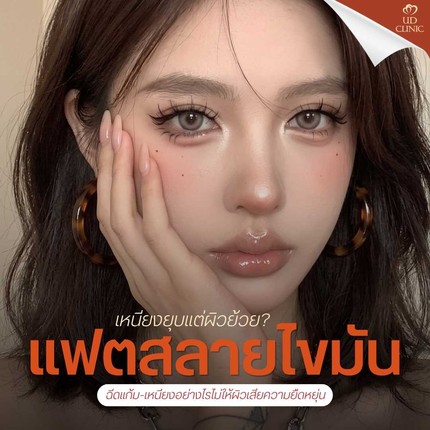 39.1 UD _ เหนียงยุบแต่ผิวย้วย_ ฉีดแฟตสลายไขมันแก้ม-เหนียงอย่างไรไม่ให้ผิวเสียความยืดหยุ่น