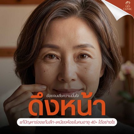 9.1 UD _ _ย้อยจนเสียความมั่นใจ_ ดึงหน้า Deep Face Lock แก้ปัญหาร่องแก้มลึก-เหนียงห้อยในคนอายุ 40+ ได้อย่างไร