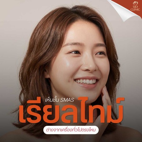 14.3 UD _ เจาะลึก Ulthera ยิงยกกระชับ แบบเห็นชั้น SMAS Real-time ต่างจากเครื่องยกกระชับทั่วไปอย่างไร_