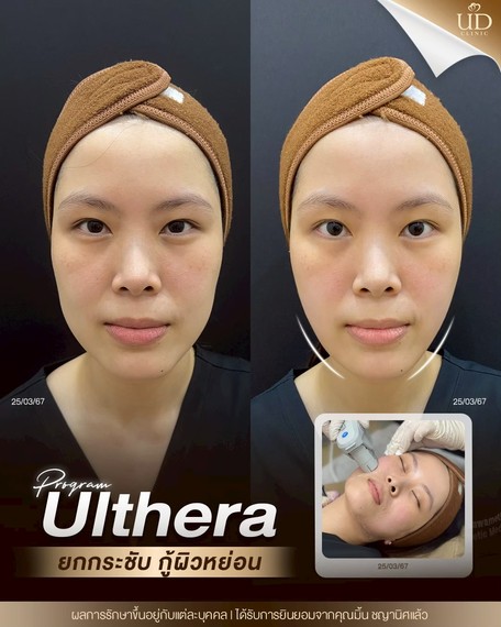LINE_ALBUM_Skin UD Clinic 2_260813_2
