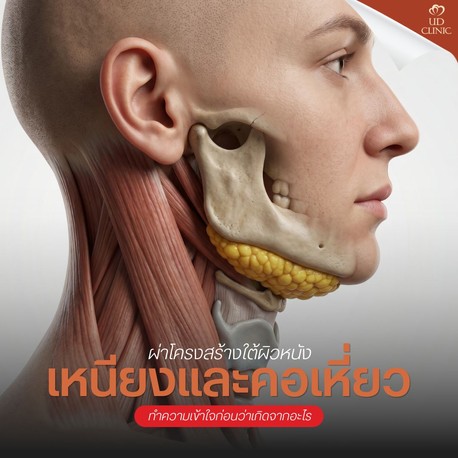 43.2 UD _ เปรียบเทียบดึงหน้าคอ (Neck Lift) vs ฉีดโบ_ร้อยไหมคอ แบบไหนเก็บเหนียงถาวร_