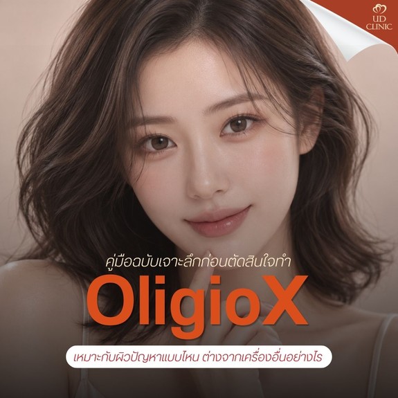 26.1 UD _ OligioX เหมาะกับผิวปัญหาแบบไหน ต่างจากเครื่องอื่นอย่างไร คู่มือฉบับเจาะลึกก่อนตัดสินใจทำ