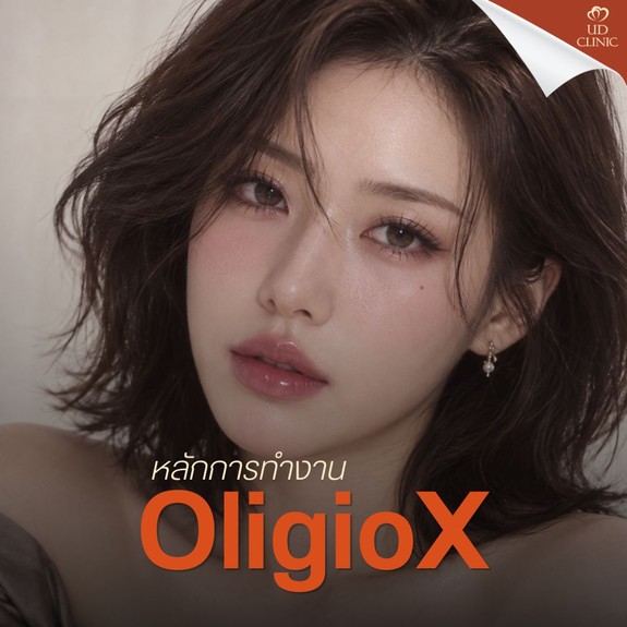 26.2 UD _ OligioX เหมาะกับผิวปัญหาแบบไหน ต่างจากเครื่องอื่นอย่างไร คู่มือฉบับเจาะลึกก่อนตัดสินใจทำ