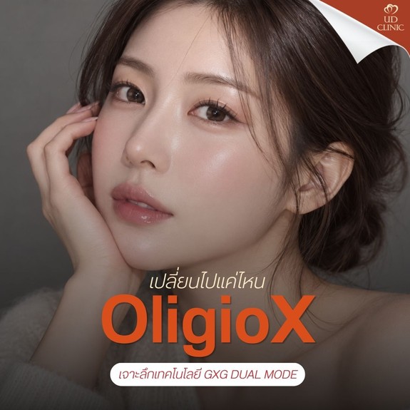 48.1 UD _ OligioX ก่อน-หลัง 1 เดือน เปลี่ยนไปแค่ไหน_ เจาะลึกเทคโนโลยี GXG Dual Mode ที่คนสายยกกระชับผิวกำลังพูดถึง