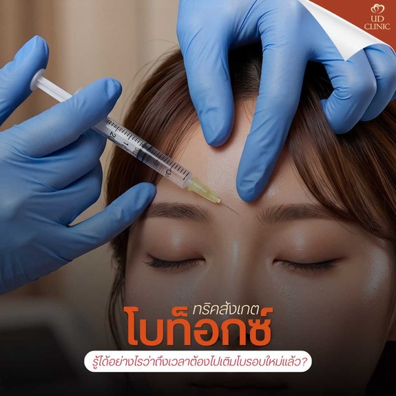 49.1 UD _ ทริคสังเกต _โบท็อกซ์เสื่อมสภาพ_ รู้ได้อย่างไรว่าถึงเวลาต้องไปเติมโบรอบใหม่แล้ว_