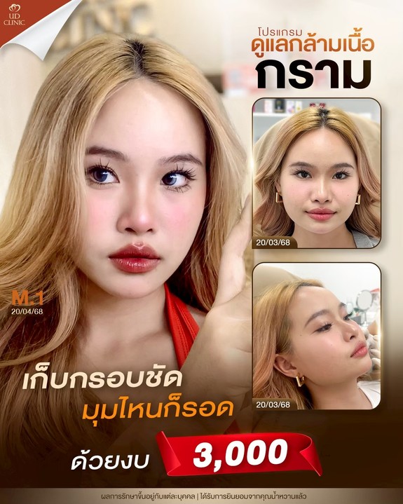 LINE_ALBUM_Skin UD Clinic 3_260915_1