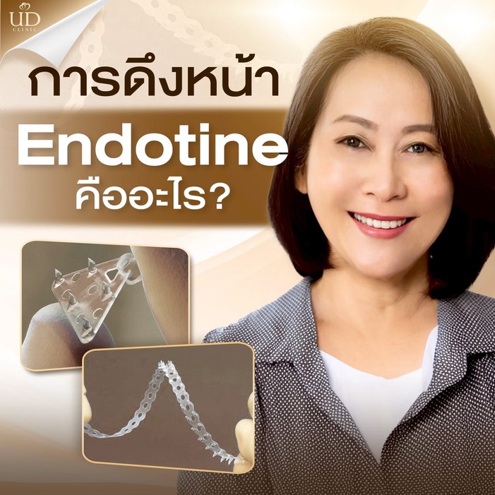 ภาพประกอบบทความ