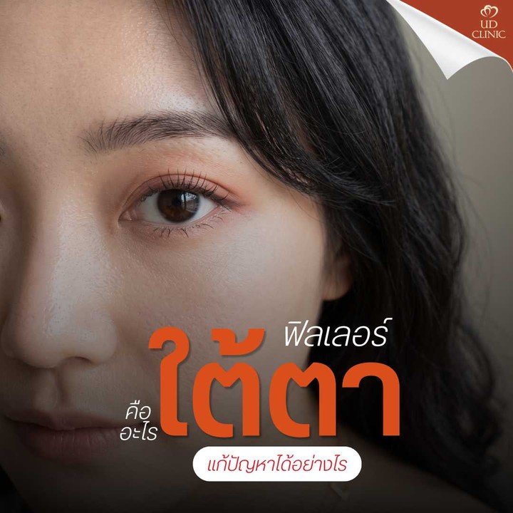 13.2 UD _ นอนน้อยแต่นอนนะ เคลียร์ปัญหา _ขอบตาดำเป็นหมีแพนด้า_ ด้วยฟิลเลอร์ใต้ตา เติมสดใสให้ตาดูตื่น