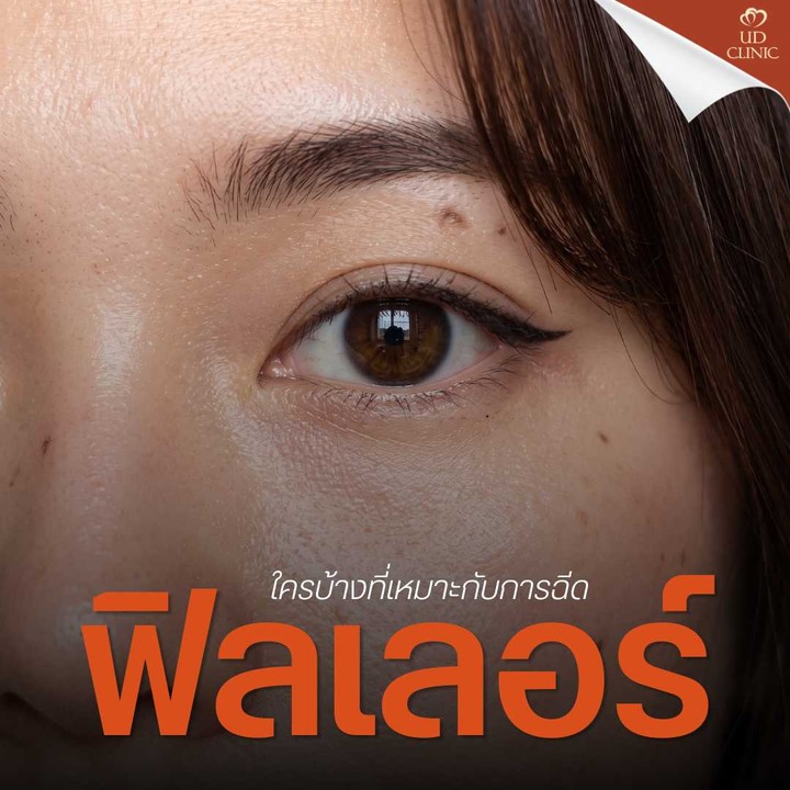 13.3 UD _ นอนน้อยแต่นอนนะ เคลียร์ปัญหา _ขอบตาดำเป็นหมีแพนด้า_ ด้วยฟิลเลอร์ใต้ตา เติมสดใสให้ตาดูตื่น