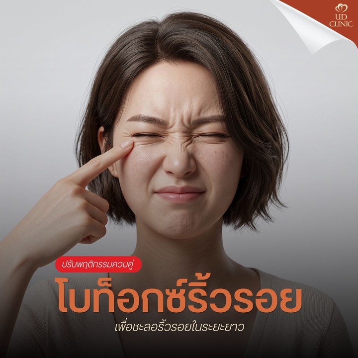16.3 UD _ นั่งหน้าคอมฯ นานจนหน้าผากย่น โบท็อกซ์ริ้วรอยตัวช่วยเร่งด่วนของชาวออฟฟิศซินโดรม