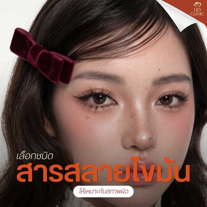 39.2 UD _ เหนียงยุบแต่ผิวย้วย_ ฉีดแฟตสลายไขมันแก้ม-เหนียงอย่างไรไม่ให้ผิวเสียความยืดหยุ่น