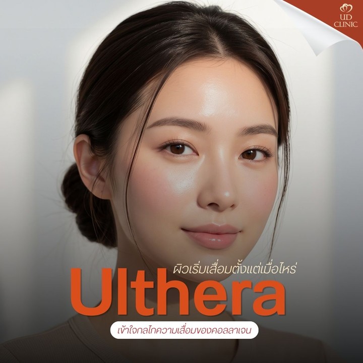 55.2 UD _ Ulthera เหมาะกับคนอายุเท่าไหร่_ ทำไมวัย 30+ ถึงควรเริ่มทำ Ulthera กระตุ้นคอลลาเจนก่อนผิวทรุด