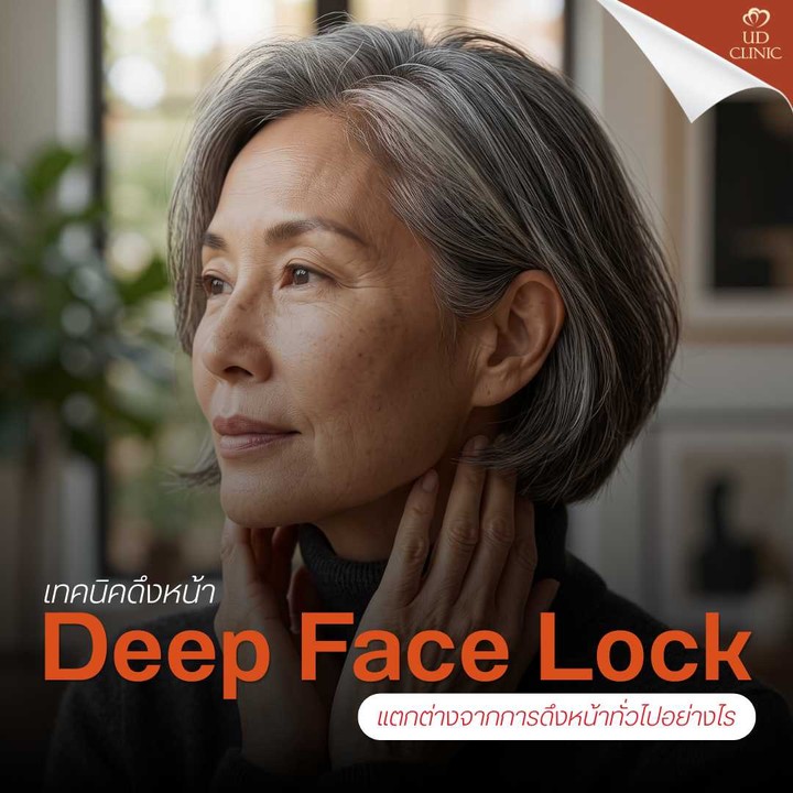 9.3 UD _ _ย้อยจนเสียความมั่นใจ_ ดึงหน้า Deep Face Lock แก้ปัญหาร่องแก้มลึก-เหนียงห้อยในคนอายุ 40+ ได้อย่างไร