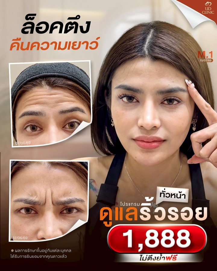 LINE_ALBUM_Skin UD Clinic 3_260827_1