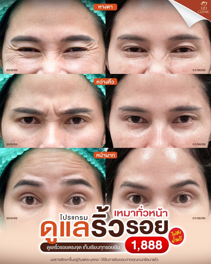 LINE_ALBUM_Skin UD Clinic 3_260827_2