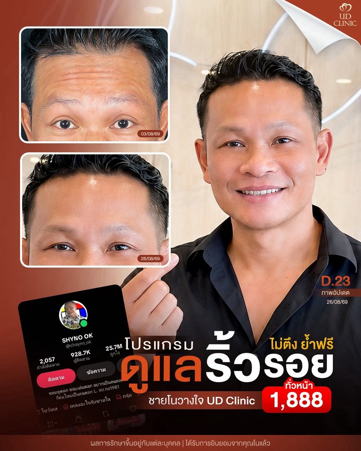 LINE_ALBUM_Skin UD Clinic 3_261014_2