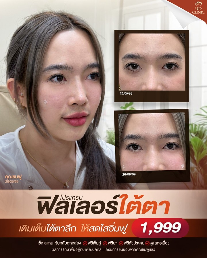 LINE_ALBUM_Skin UD Clinic 3_261021_1