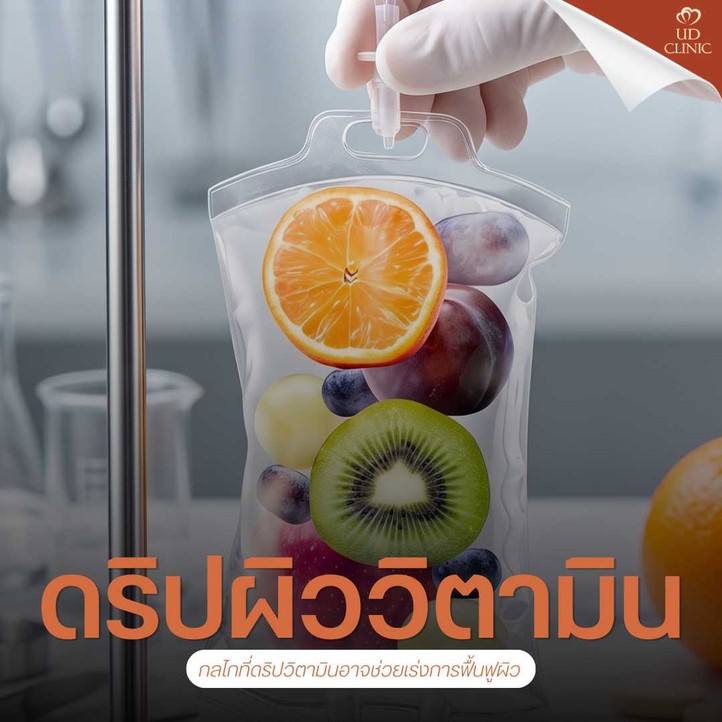 37.3 UD _ แดดเมืองไทยร้อนจนผิวไหม้ ดริปผิววิตามินสูตรกู้ผิวไหม้แดด (Sunburn) ช่วยฟื้นฟูเร่งด่วนได้อย่างไร