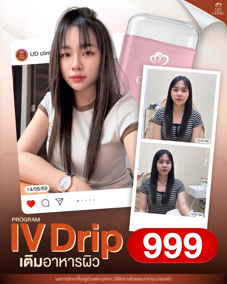 LINE_ALBUM_Skin UD Clinic 3_260910_1