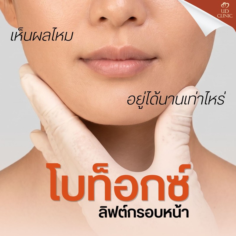 22.2 UD _ โบท็อกซ์ลิฟท์กรอบหน้า ด้วยเทคนิค Dermolift ช่วยหน้าเรียวอย่างไร_