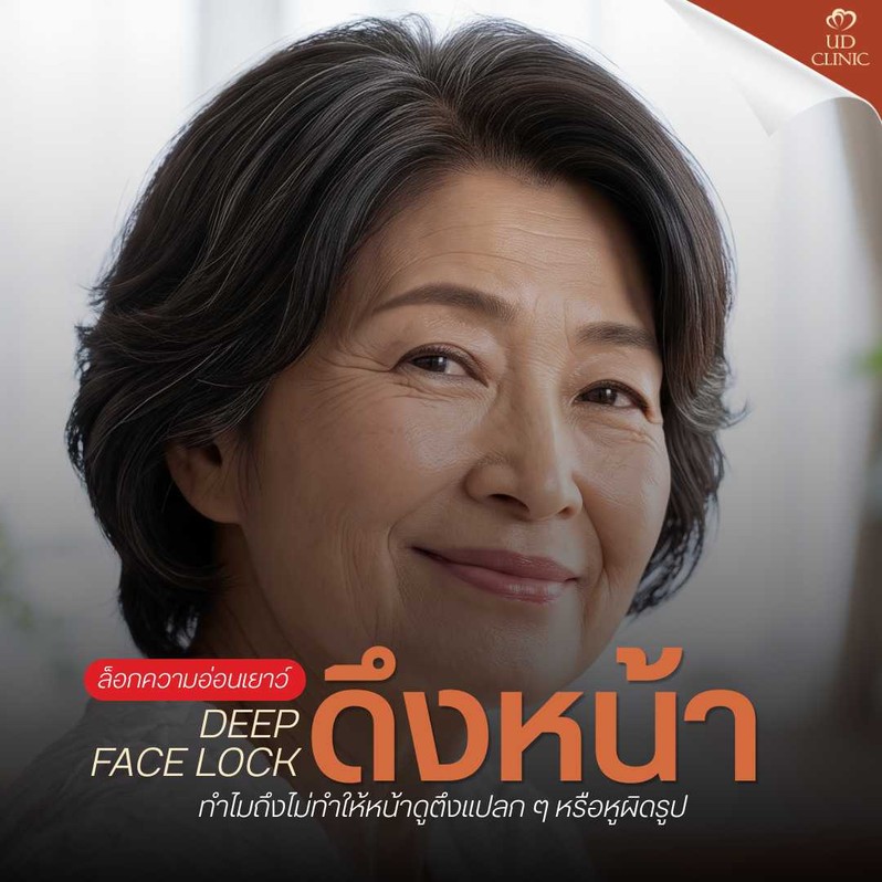 22.3 UD _ ดึงหน้า Deep Face Lock ล็อกความอ่อนเยาว์ได้นานแค่ไหน_ ทำไมถึงไม่ทำให้หน้าดูตึงแปลก ๆ หรือหูผิดรูป