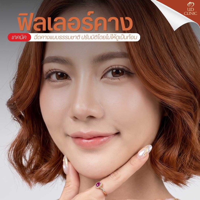 26.3 UD _ หน้าสั้น คางตัด ถ่ายรูปมุมตรงแล้วไม่มั่นใจ_ ปรับมิติใบหน้าให้ละมุน ไม่เป็นก้อน ด้วยฟิลเลอร์คางเทคนิคธรรมชาติ