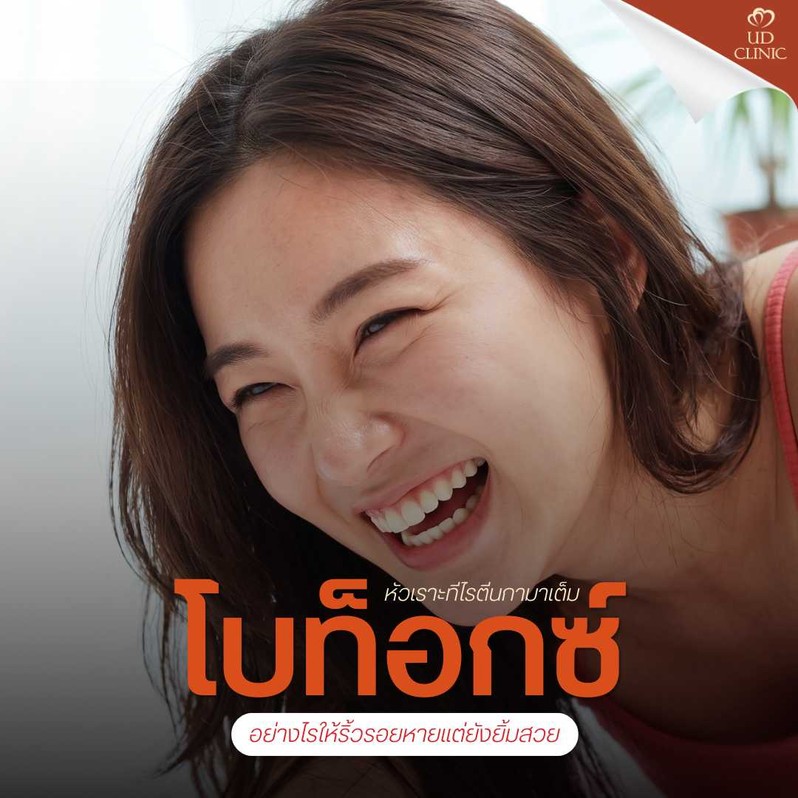 41.1 UD _ หัวเราะทีไรตีนกามาเต็ม ฉีดโบท็อกซ์หางตาและรอบดวงตาอย่างไร ให้ริ้วรอยหายแต่ยังยิ้มสวย ตาไม่แข็งเป็นหุ่นยนต์