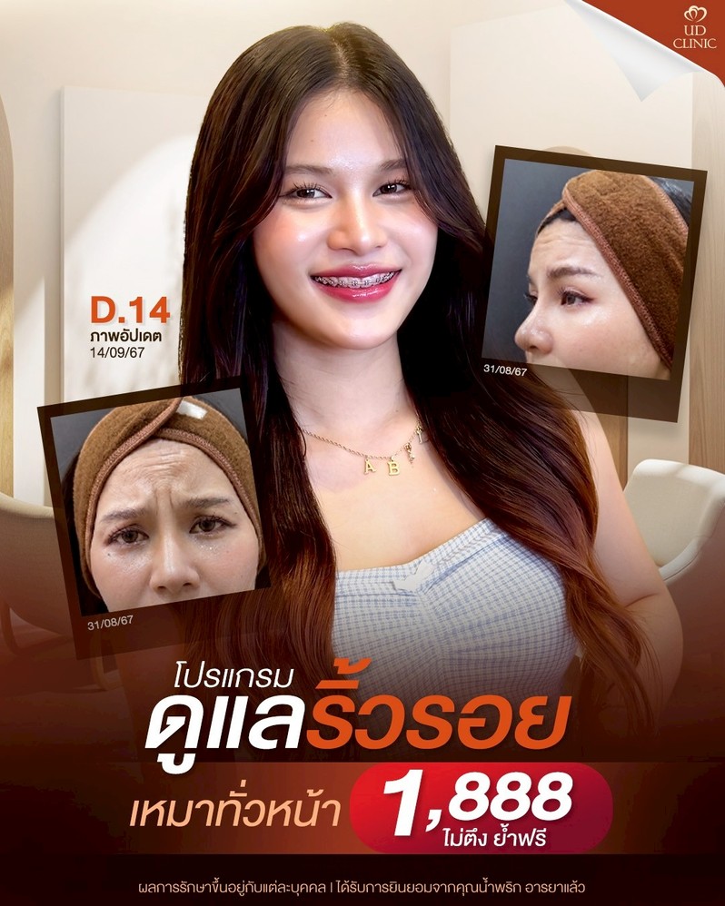 LINE_ALBUM_Skin UD Clinic 3_260808_3