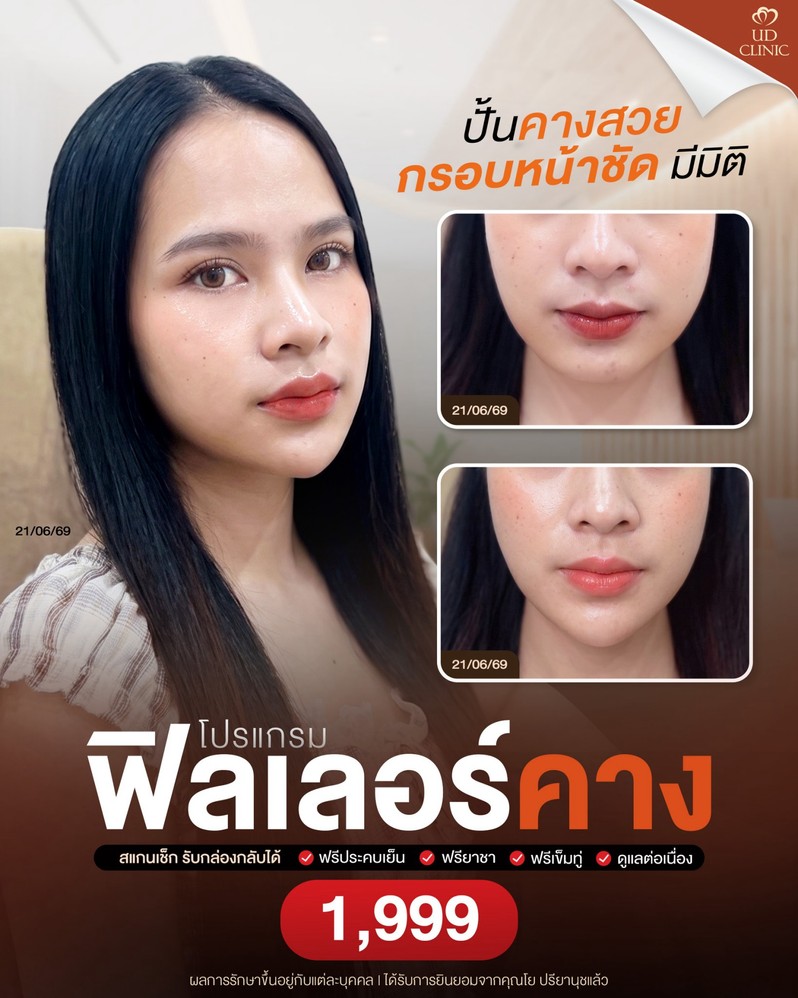 LINE_ALBUM_Skin UD Clinic 3_260903_1