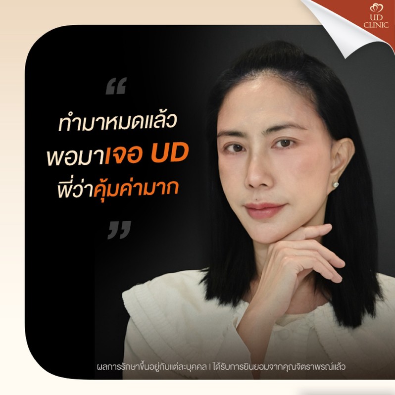 LINE_ALBUM_UD-ศัลยกรรมดึงหน้า 2_260818_1