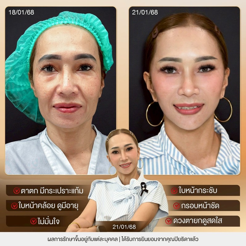 S152944740