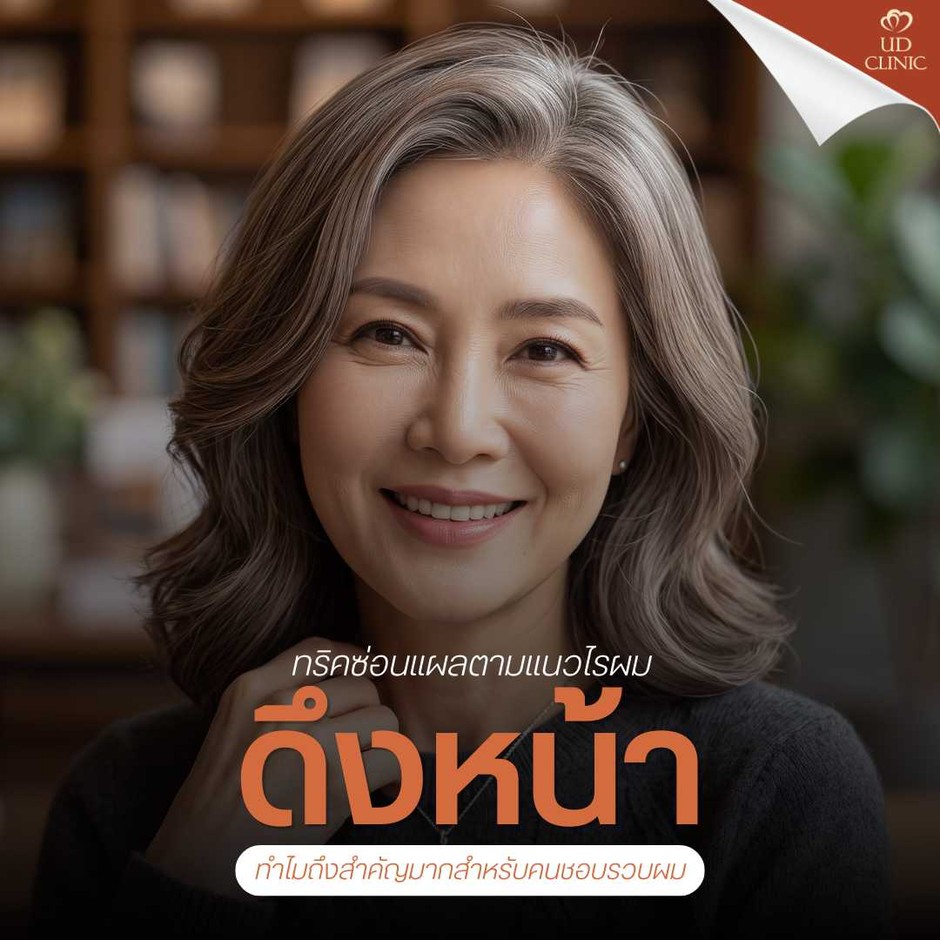 39.2 UD _ ดึงหน้า Deep Face Lock แผลผ่าตัดอยู่ตรงไหน_ เปิดทริคซ่อนแผลตามแนวเส้นผมสำหรับคนชอบรวบผม