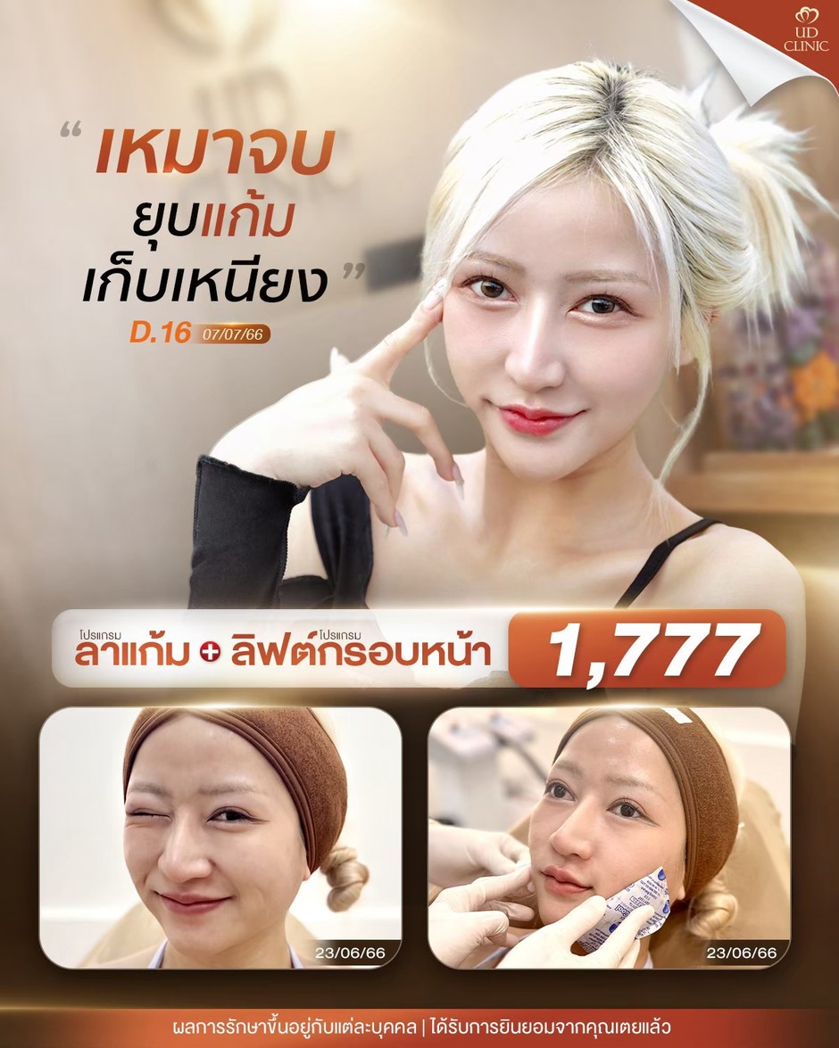 LINE_ALBUM_Skin UD Clinic 3_260915_2