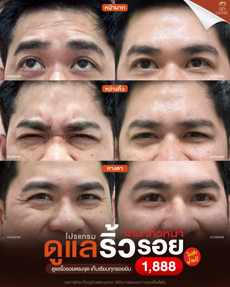 LINE_ALBUM_Skin UD Clinic 3_261007_1