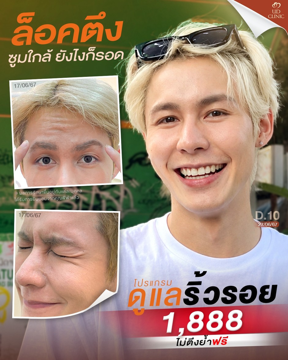 LINE_ALBUM_Skin UD Clinic 3_261007_2