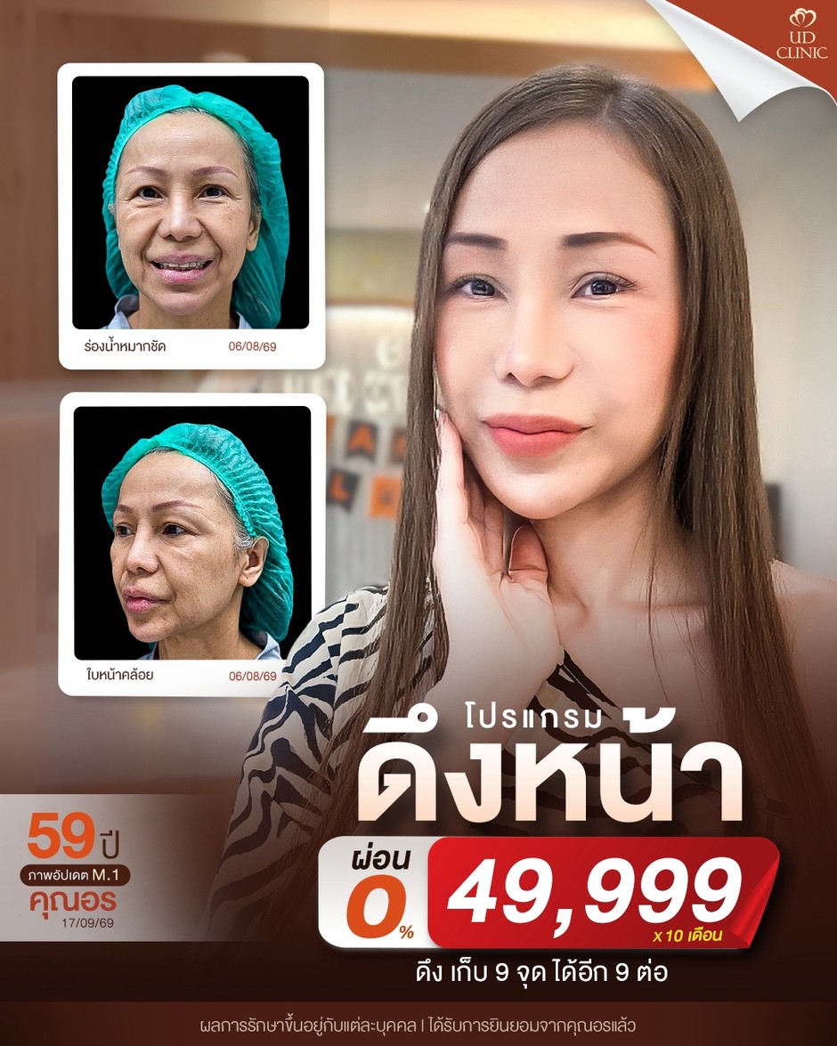 LINE_ALBUM_UD-ศัลยกรรมดึงหน้า 2_260918_1
