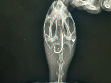 X-ray-1