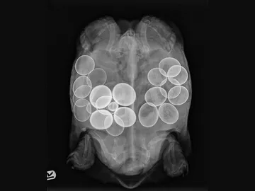X-ray-2