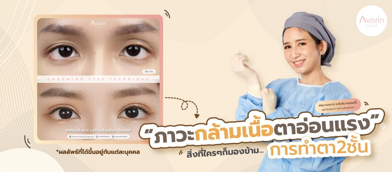 กล้ามเนื้อตาอ่อนแรง