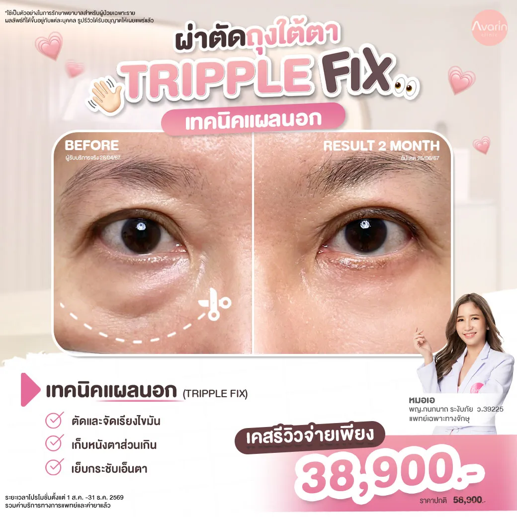 คุณหลา-1