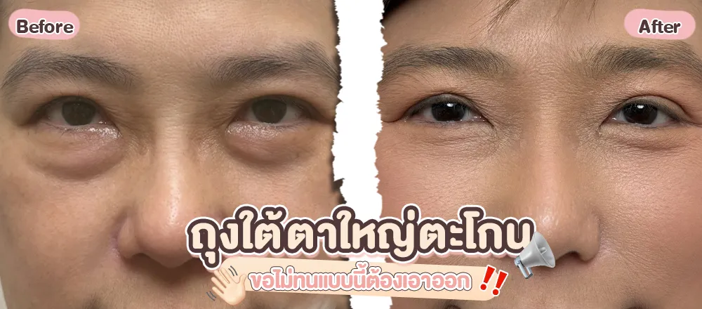 คุณเสา