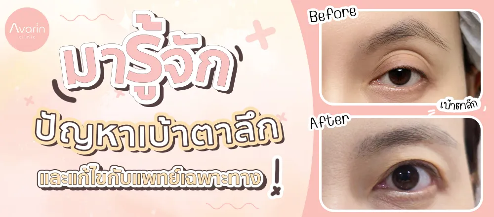 ตาโหล
